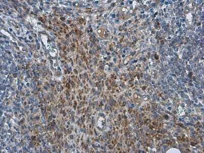 Immunohistochemistry-Paraffin PRRSV M Protein Antibody - BSA Free