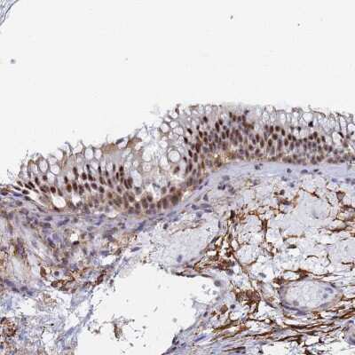 Immunohistochemistry: PRRT4 Antibody [NBP2-37917] - Staining of human nasopharynx shows strong nuclear positivity in respiratory epithelial cells.