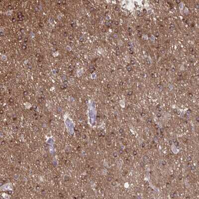 Immunohistochemistry: PRRT4 Antibody [NBP2-37936] - Staining of human cerebral cortex shows strong cytoplasmic positivity in glial cells.