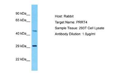 Western Blot: PRRT4 Antibody [NBP2-85545] - Host: Rabbit. Target Name: PRRT4. Sample Tissue: Human 293T Whole Cell. Antibody Dilution: 1ug/ml