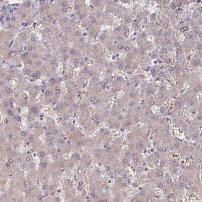 Immunohistochemistry-Paraffin: PRRX1 Antibody [NBP2-13816] - Staining of human liver shows no nuclear positivity in hepatocytes, as expected.