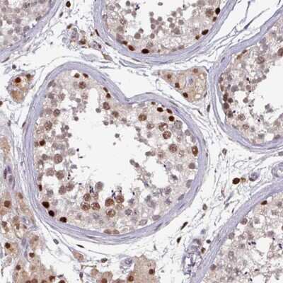 Immunohistochemistry-Paraffin: PRRX1 Antibody [NBP2-13816] - Staining of human testis shows moderate to strong nuclear positivity in cells in seminiferous ducts, as well as Leydig cells.
