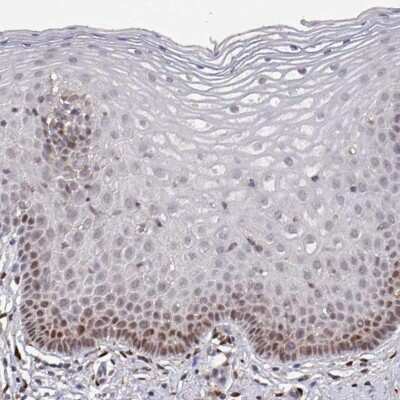 Immunohistochemistry-Paraffin: PRRX1 Antibody [NBP2-13816] - Staining of human uterine cervix shows moderate nuclear positivity in basal cells of squamous epithelium.