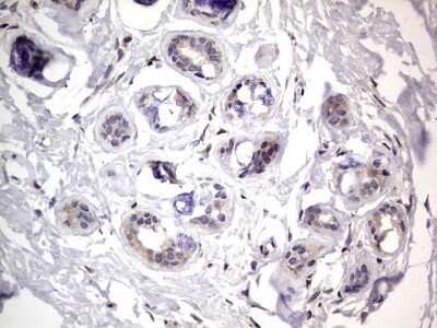 Immunohistochemistry: PRRX1 Antibody (OTI1E10) - Azide and BSA Free [NBP2-73678] - Analysis of Human breast tissue. (Heat-induced epitope retrieval by 1 mM EDTA in 10mM Tris, pH8.5, 120C for 3min)