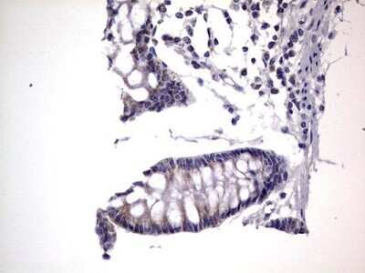 Immunohistochemistry: PRRX1 Antibody (OTI1E10) - Azide and BSA Free [NBP2-73678] - Analysis of Human colon tissue. (Heat-induced epitope retrieval by 1 mM EDTA in 10mM Tris, pH8.5, 120C for 3min)