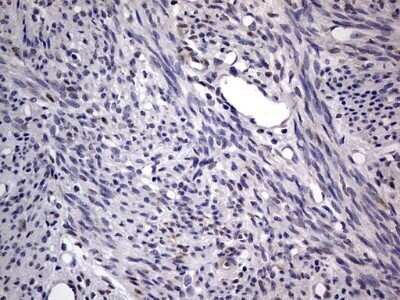 Immunohistochemistry: PRRX1 Antibody (OTI1E10) - Azide and BSA Free [NBP2-73678] - Analysis of Human endometrium tissue. (Heat-induced epitope retrieval by 1 mM EDTA in 10mM Tris, pH8.5, 120C for 3min)