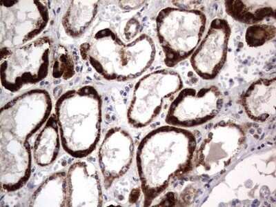 Immunohistochemistry: PRRX1 Antibody (OTI1E10) - Azide and BSA Free [NBP2-73678] - Analysis of Human Kidney tissue. (Heat-induced epitope retrieval by 1 mM EDTA in 10mM Tris, pH8.5, 120C for 3min)