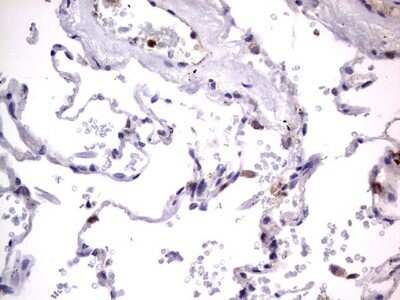 Immunohistochemistry: PRRX1 Antibody (OTI1E10) - Azide and BSA Free [NBP2-73678] - Analysis of Human lung tissue. (Heat-induced epitope retrieval by 1 mM EDTA in 10mM Tris, pH8.5, 120C for 3min)