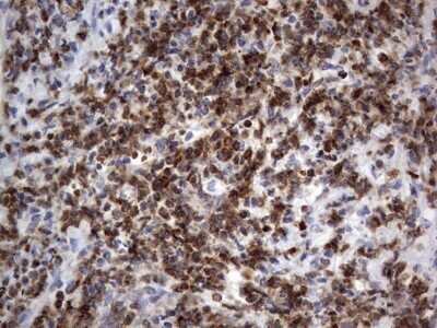 Immunohistochemistry: PRRX1 Antibody (OTI1E10) - Azide and BSA Free [NBP2-73678] - Analysis of Human lymph node tissue. (Heat-induced epitope retrieval by 1 mM EDTA in 10mM Tris, pH8.5, 120C for 3min)