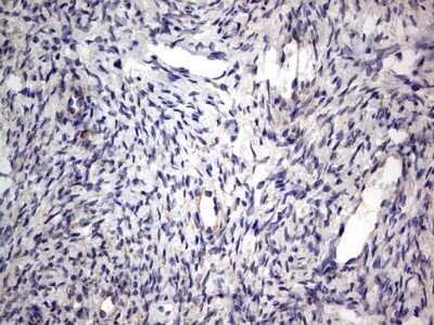 Immunohistochemistry: PRRX1 Antibody (OTI1E10) - Azide and BSA Free [NBP2-73678] - Analysis of Human Ovary tissue. (Heat-induced epitope retrieval by 1 mM EDTA in 10mM Tris, pH8.5, 120C for 3min)