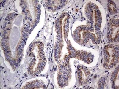 Immunohistochemistry: PRRX1 Antibody (OTI1E10) - Azide and BSA Free [NBP2-73678] - Analysis of Human prostate tissue. (Heat-induced epitope retrieval by 1 mM EDTA in 10mM Tris, pH8.5, 120C for 3min)