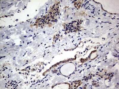 Immunohistochemistry: PRRX1 Antibody (OTI1E10) - Azide and BSA Free [NBP2-73678] - Analysis of Human thyroid tissue. (Heat-induced epitope retrieval by 1 mM EDTA in 10mM Tris, pH8.5, 120C for 3min)