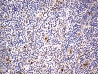 Immunohistochemistry: PRRX1 Antibody (OTI1E10) - Azide and BSA Free [NBP2-73678] - Analysis of Human tonsil tissue. (Heat-induced epitope retrieval by 1 mM EDTA in 10mM Tris, pH8.5, 120C for 3min)