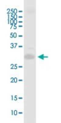 Western Blot: PRRX1 Antibody [H00005396-B01P] - Analysis of PRRX1 expression in human spleen.