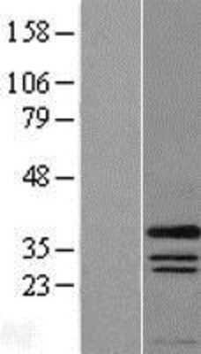 Western Blot: PRRX1 Overexpression Lysate (Adult Normal) [NBL1-14840] Left-Empty vector transfected control cell lysate (HEK293 cell lysate); Right -Over-expression Lysate for PRRX1.