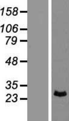 Western Blot: PRRX1 Overexpression Lysate (Adult Normal) [NBP2-07566] Left-Empty vector transfected control cell lysate (HEK293 cell lysate); Right -Over-expression Lysate for PRRX1.