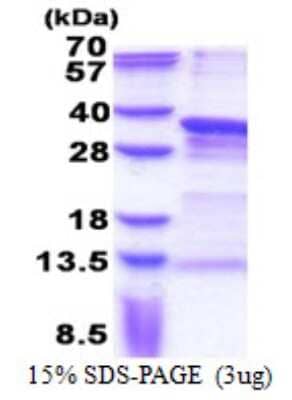 SDS-PAGE Recombinant Human PRRX1 His Protein