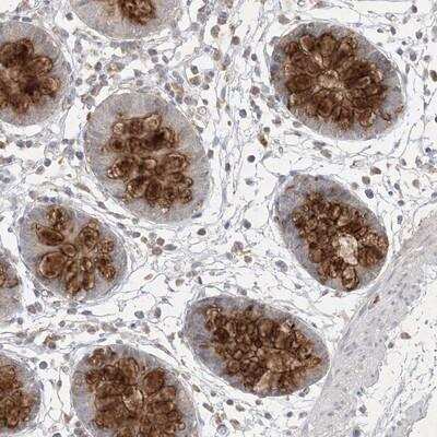 Immunohistochemistry: PRSS36 Antibody [NBP1-93725] - Staining of human colon shows strong cytoplasmic positivity in glandular cells.