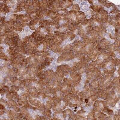 Immunohistochemistry-Paraffin: PRSS42 Antibody [NBP1-93439] - Staining of human pancreas shows strong cytoplasmic positivity in exocrine glandular cells.
