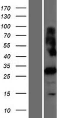 Western Blot: PRSS42 Overexpression Lysate (Adult Normal) [NBP2-04826] Left-Empty vector transfected control cell lysate (HEK293 cell lysate); Right -Over-expression Lysate for PRSS42.