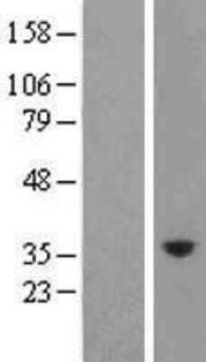 Western Blot: PRSS57 Overexpression Lysate (Adult Normal) [NBL1-12345] Left-Empty vector transfected control cell lysate (HEK293 cell lysate); Right -Over-expression Lysate for PRSS57.