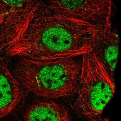 Immunocytochemistry/Immunofluorescence: PRTFDC1 Antibody [NBP1-83261] - Immunofluorescent staining of human cell line A-431 shows localization to nucleoplasm & the Golgi apparatus.