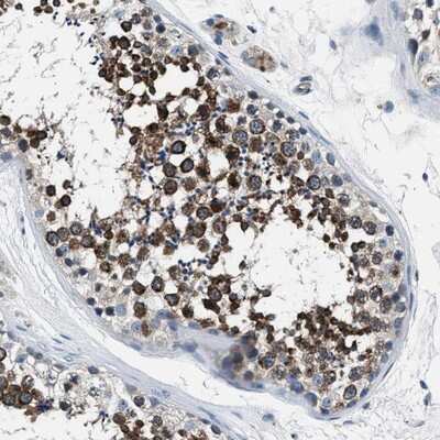 Immunohistochemistry-Paraffin: PRTFDC1 Antibody [NBP1-83261] - Staining of human testis shows strong cytoplasmic positivity in cells in seminiferus ducts.