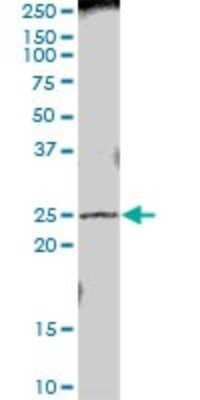 Western Blot: PRTFDC1 Antibody [H00056952-B01P] - Analysis of PRTFDC1 expression in IMR-32.