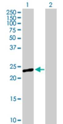 Western Blot: PRTFDC1 Antibody [H00056952-B01P] - Analysis of PRTFDC1 expression in transfected 293T cell line by PRTFDC1 polyclonal antibody.  Lane 1: PRTFDC1 transfected lysate(24.75 KDa). Lane 2: Non-transfected lysate.
