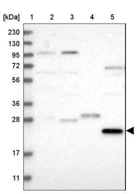 Western Blot: PRTFDC1 Antibody [NBP1-83261] - Lane 1: Marker  [kDa] 230, 130, 95, 72, 56, 36, 28, 17, 11.  Lane 2: Human cell line RT-4.  Lane 3: Human cell line U-251MG sp.  Lane 4: Human plasma (IgG/HSA depleted).  Lane 5: Human liver tissue