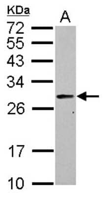 Western Blot: PRTFDC1 Antibody [NBP2-19972] - Sample (30 ug of whole cell lysate) A: IMR32 12% SDS PAGE gel, diluted at 1:1000.