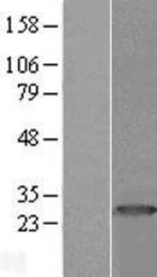 Western Blot: PRTFDC1 Overexpression Lysate (Adult Normal) [NBL1-14849] Left-Empty vector transfected control cell lysate (HEK293 cell lysate); Right -Over-expression Lysate for PRTFDC1.