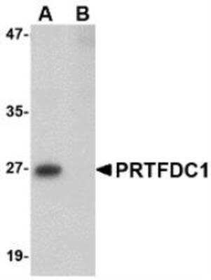 Western Blot: PRTFDC1 Peptide [NBP1-76358PEP] - blocks the antibody activity completely in Western blot by incubating the peptide with equal volume of antibody for 30 min at 37C.