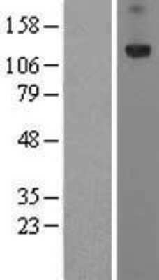 Western Blot: PRTG Overexpression Lysate (Adult Normal) [NBL1-14850] Left-Empty vector transfected control cell lysate (HEK293 cell lysate); Right -Over-expression Lysate for PRTG.