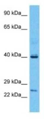 Western Blot: PRUNE Antibody [NBP3-09948] - Western blot analysis of PRUNE in Fetal Liver lysates. Antibody dilution at 1.0ug/ml