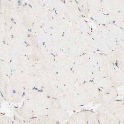 Immunohistochemistry-Paraffin: PSAP Antibody [NBP1-83363] - Staining of human skeletal muscle shows very weak positivity in myocytes as expected.