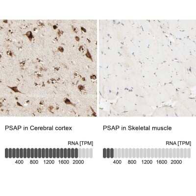 Immunohistochemistry-Paraffin PSAP Antibody - BSA Free