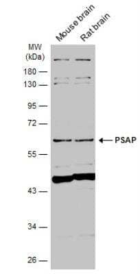 Western Blot: PSAP Antibody [NBP1-33459] - Various tissue extracts (50 ug) were separated by 10% SDS-PAGE, and the membrane was blotted with PSAP antibody [N1N3] diluted at 1:1000. The HRP-conjugated anti-rabbit IgG antibody was used to detect the primary antibody.