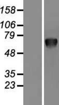 Western Blot PSAP Overexpression Lysate