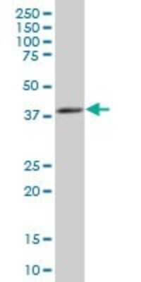 Western Blot: PSAT1 Antibody [H00029968-A01] - Analysis of PSAT1 expression in IMR-32 (Cat # L008V1).