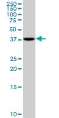 Western Blot: PSAT1 Antibody [H00029968-A01] - Analysis of PSAT1 expression in MES-SA/Dx5.