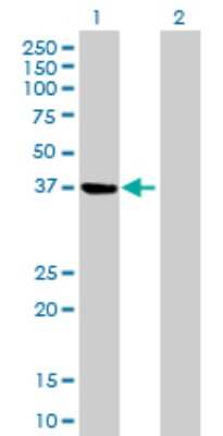 Western Blot: PSAT1 Antibody [H00029968-B01P] - Analysis of PSAT1 expression in transfected 293T cell line by PSAT1 polyclonal antibody.  Lane 1: PSAT1 transfected lysate(40.7 KDa). Lane 2: Non-transfected lysate.