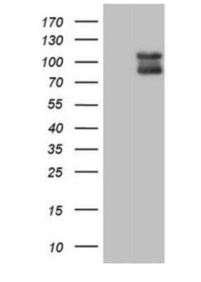 Western Blot: PSD-95 Antibody (OTI12A5) - Azide and BSA Free [NBP2-73679] - HEK293T cells were transfected with the pCMV6-ENTRY control (Left lane) or pCMV6-ENTRY DLG4 (Right lane) cDNA for 48 hrs and lysed. Equivalent amounts of cell lysates (5 ug per lane) were separated by SDS-PAGE and immunoblotted with antiDLG4.(1:2000)