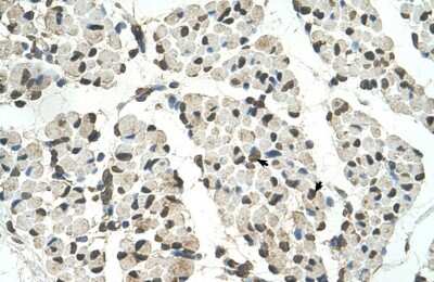 Immunohistochemistry-Paraffin: PSD3 Antibody [NBP1-55339] - Human Muscle Tissue, Skeletal muscle cells (Indicated with Arrows) 4-8ug/ml.