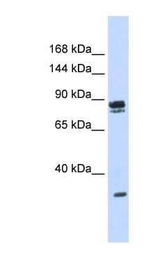 Western Blot: PSD3 Antibody [NBP1-55338] - 293T cells lysate, concentration 0.2-1 ug/ml.