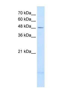 Western Blot: PSD3 Antibody [NBP1-55339] - A204 cell lysate, Antibody Titration: 2.5ug/ml