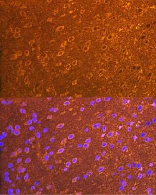 Immunocytochemistry/Immunofluorescence: PSD93 Antibody (0G4O6) [NBP3-15849] - Immunofluorescence analysis of mouse brain cells using PSD93 Rabbit mAb (NBP3-15849) at dilution of 1:100 (40x lens). Blue: DAPI for nuclear staining.