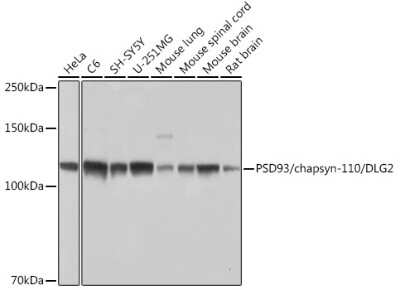 Western Blot: PSD93 Antibody (0G4O6) [NBP3-15849] - Western blot analysis of extracts of various cell lines, using PSD93 Rabbit mAb (NBP3-15849) at 1:1000 dilution. Secondary antibody: HRP Goat Anti-Rabbit IgG (H+L) at 1:10000 dilution. Lysates/proteins: 25ug per lane. Blocking buffer: 3% nonfat dry milk in TBST. Detection: ECL Basic Kit. Exposure time: 1s.