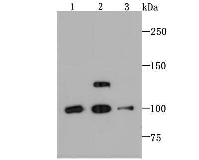 Western Blot: PSD93 Antibody (JM41-04) [NBP2-75631] - Analysis of PSD93 on different lysates using anti-PSD93 antibody at 1/1,000 dilution.Positive control:Lane 1: Hela          Lane 2: Mouse ThymusLane 3: SH-SY5Y