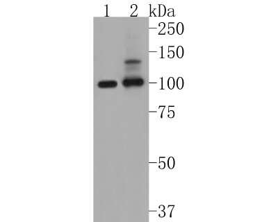 Western Blot: PSD93 Antibody (JM41-04) [NBP2-75631] - Western blot analysis of PSD93 on different lysates. Proteins were transferred to a PVDF membrane and blocked with 5% BSA in PBS for 1 hour at room temperature. The primary antibody (1/500) was used in 5% BSA at room temperature for 2 hours. Goat Anti-Rabbit IgG - HRP Secondary Antibody (HA1001) at 1:5,000 dilution was used for 1 hour at room temperature. Positive control: Lane 1: Hela cell lysate Lane 2: SH-SY5Y cell lysate